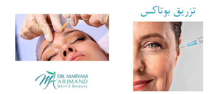 تزریق بوتاکس چیست؟