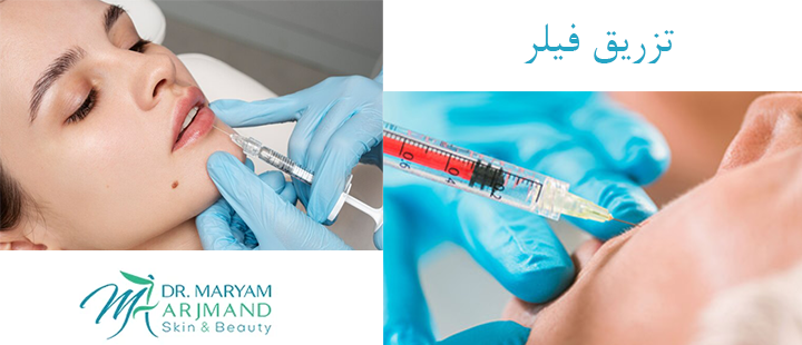 تزریق فیلر