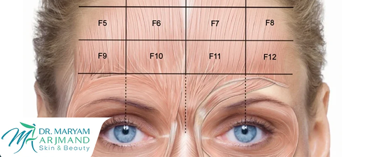 درباره تزریق بوتاکس