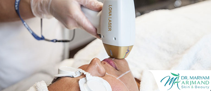 درباره لیزر موهای زائد