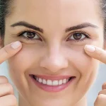 فیلر زیر چشم