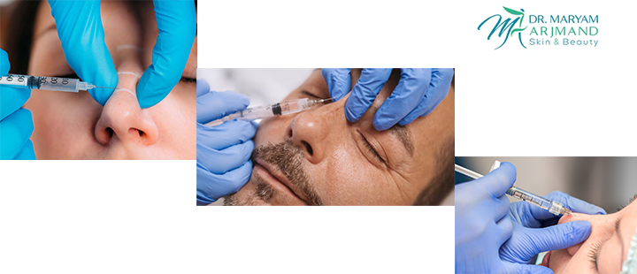 تزریق فیلر بینی چیست؟