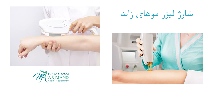درباره شارژ لیزر موهای زائد