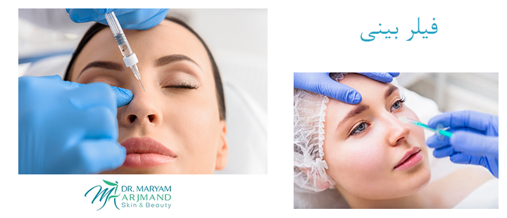 درباره فیلر بینی