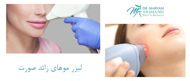 درباره لیزر موهای زائد صورت