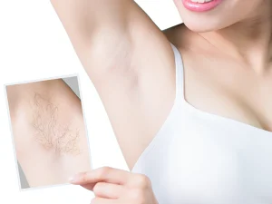 لیزر موی زائد زیر بغل