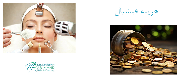 درباره هزینه فیشیال