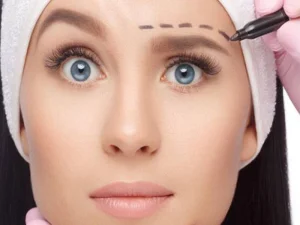 لیفت ابرو با نخ چیست؟