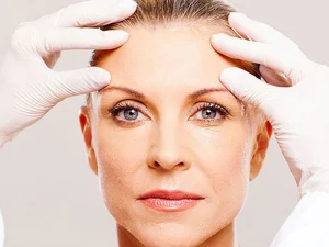 لیفت پیشانی با نخ