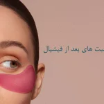 مراقبت های بعد از فیشیال