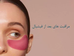 مراقبت های بعد از فیشیال