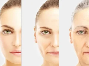 بهترین سن تزریق بوتاکس