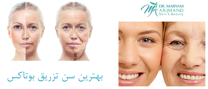 درباره بهترین سن تزریق بوتاکس