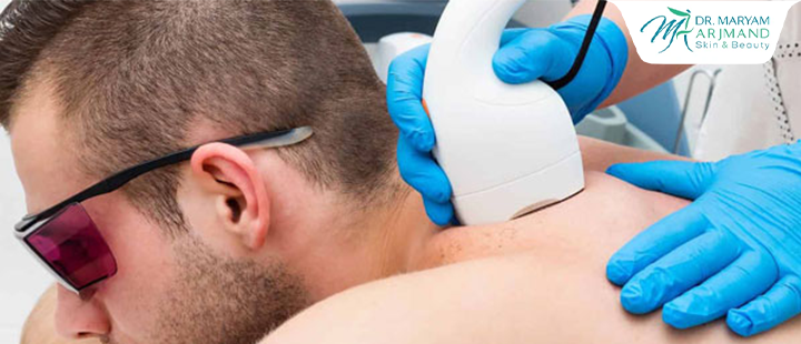 درباره لیزر موهای زائد آقایان