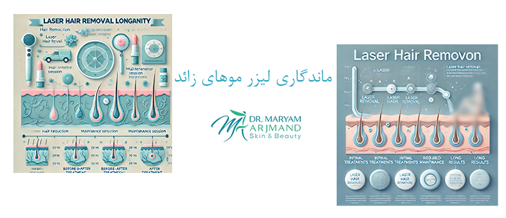 درباره ماندگاری لیزر موهای زائد