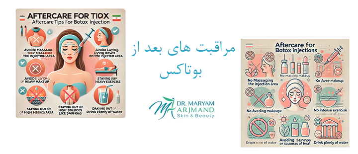 درباره مراقبت های بعد از بوتاکس 