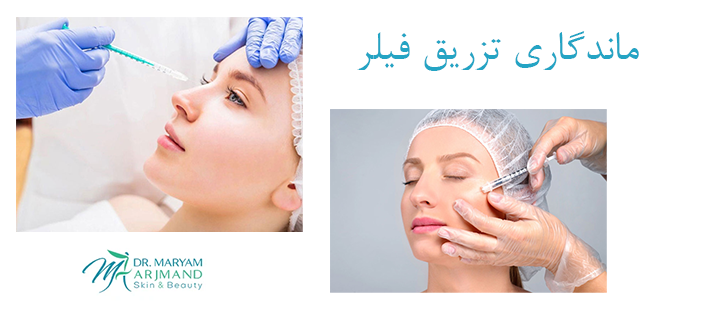 ماندگاری تزریق فیلر چقدر است؟