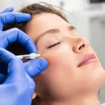 مراقبت‌ های بعد از بوتاکس