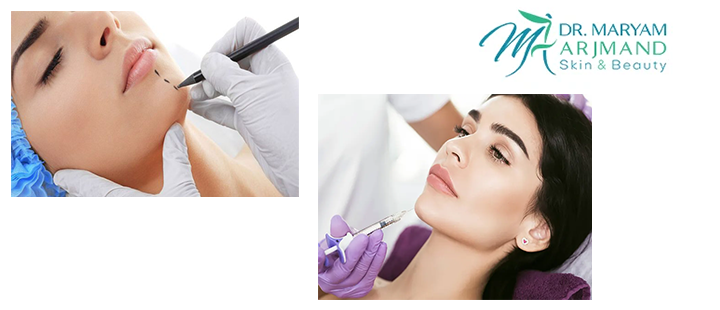 آَشنایی با تزریق فیلر چانه