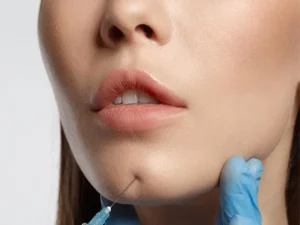 تزریق فیلر چانه