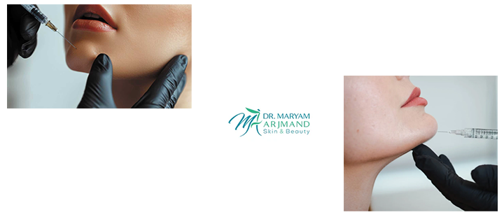 تزریق فیلر چانه چیست؟