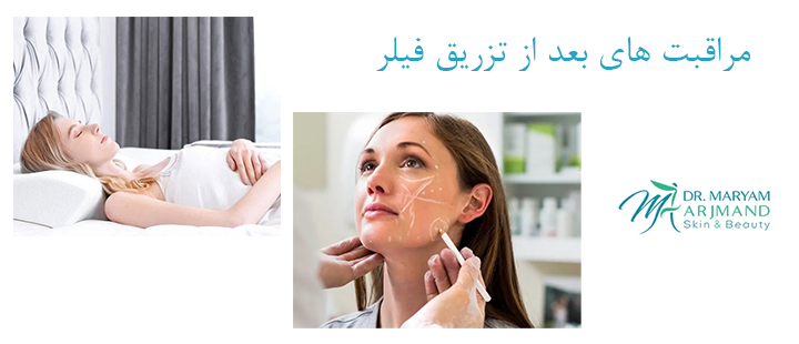 درباره مراقبت های بعد از تزریق فیلر 