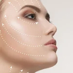 درد لیفت با نخ