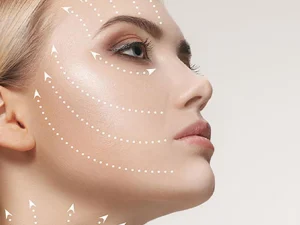 درد لیفت با نخ