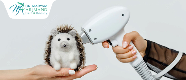 علت ریزش مو بعد از لیزر موهای زائد