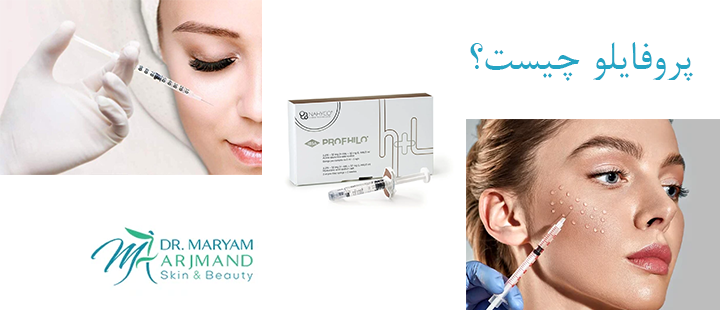 درباره تزریق پروفایلو 