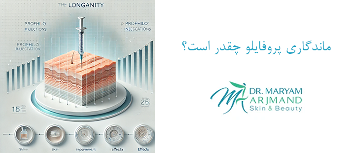 درباره ماندگاری پروفایلو 