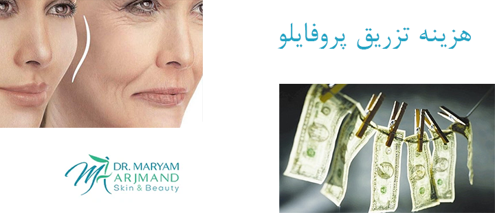 درباره هزینه تزریق پروفایلو 