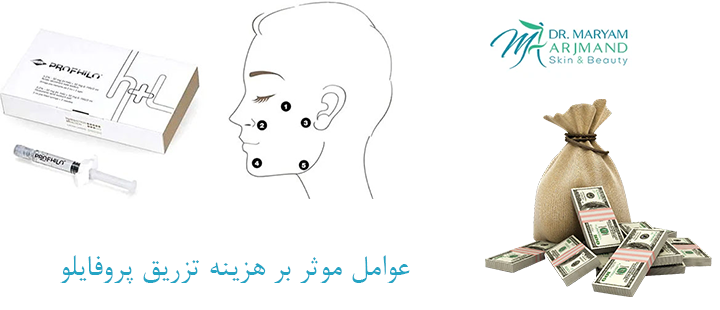 عوامل موثر بر هزینه پروفایلو