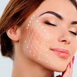 ماندگاری لیفت صورت با نخ