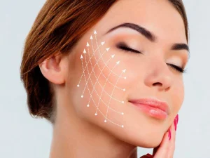 ماندگاری لیفت صورت با نخ