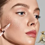 هزینه تزریق پروفایلو