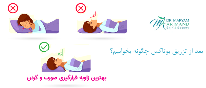 بعد از تزریق بوتاکس چگونه بخوابیم؟