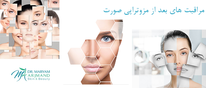 درباره مراقبت های بعد از مزوتراپی صورت 
