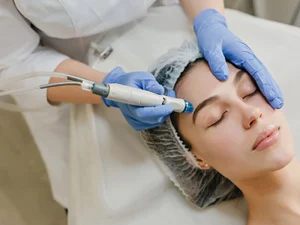 ماندگاری مزوتراپی صورت