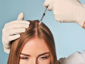 مزوتراپی مو