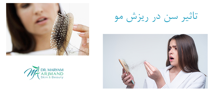 تاثیر سن در ریزش مو