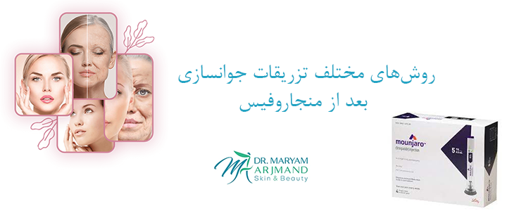 روش‌های مختلف تزریقات جوانسازی بعد از منجاروفیس 