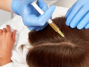 مراقبت های بعد از مزوتراپی مو