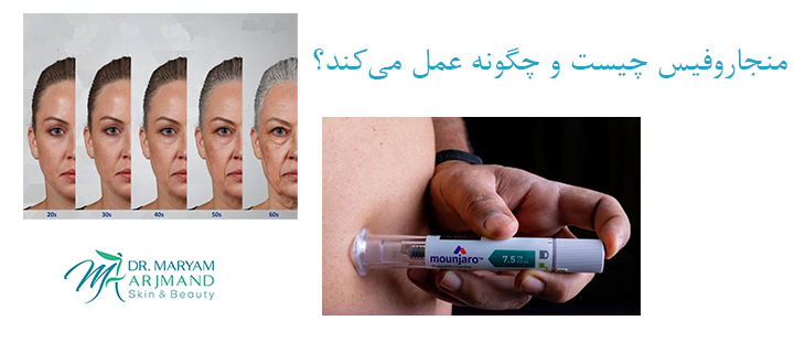 منجاروفیس چیست و چگونه عمل می‌کند؟