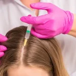 هزینه مزوتراپی مو