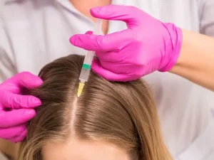 هزینه مزوتراپی مو