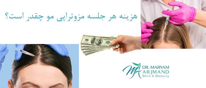 آیا هزینه مزوتراپی مو برای هر فرد یکسان است؟