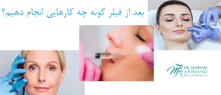 بعد از فیلر گونه چه کارهایی انجام دهیم؟