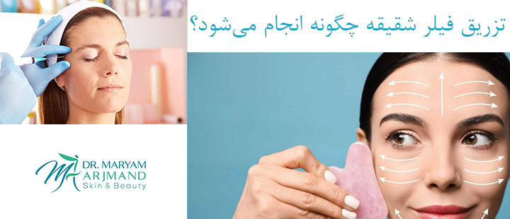 تزریق فیلر شقیقه چگونه انجام می‌شود؟