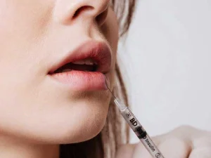 درد بعد از تزریق فیلر